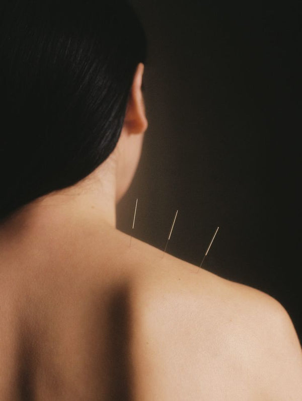 Body Acupuncture