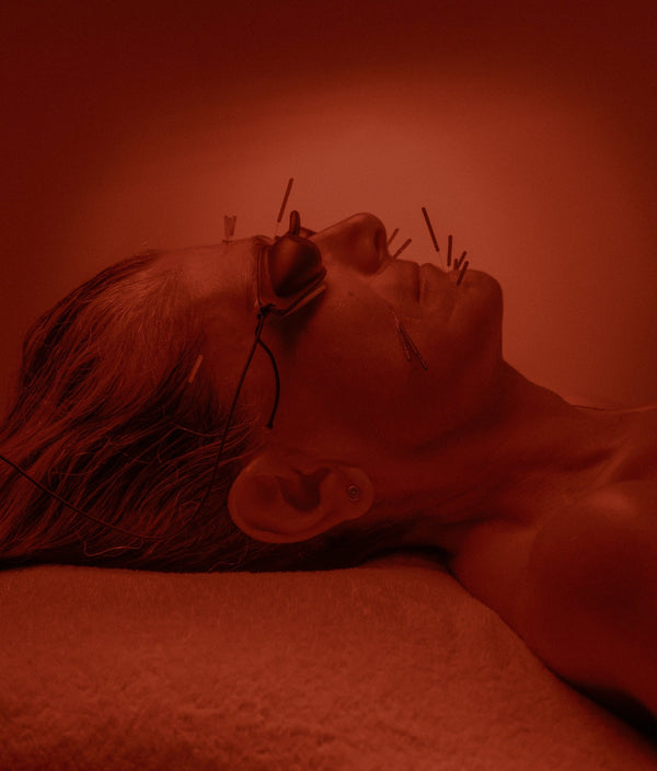 Acupuncture Facial