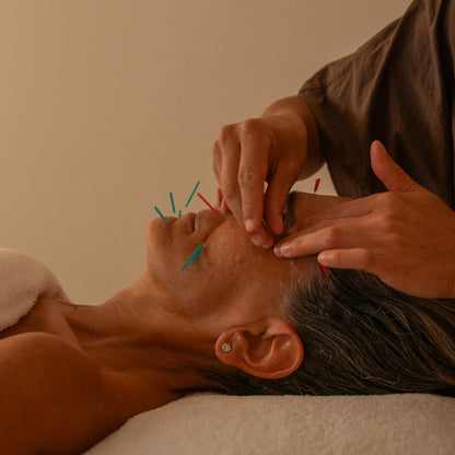 Person receiving facial acupuncture with fine needles inserted into the skin.