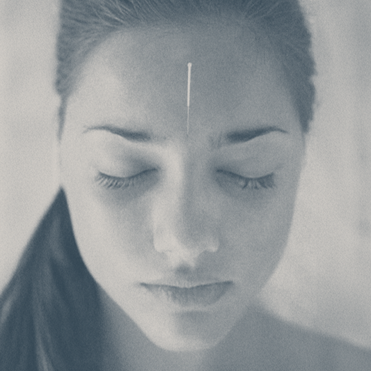 Acupuncture & Yin Yoga Workshop